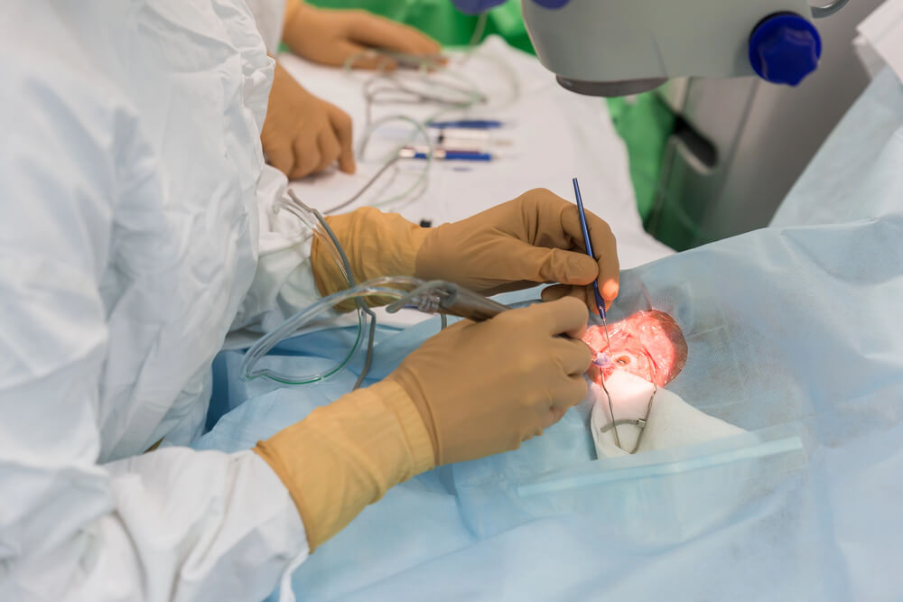 Cough During Cataract surgery