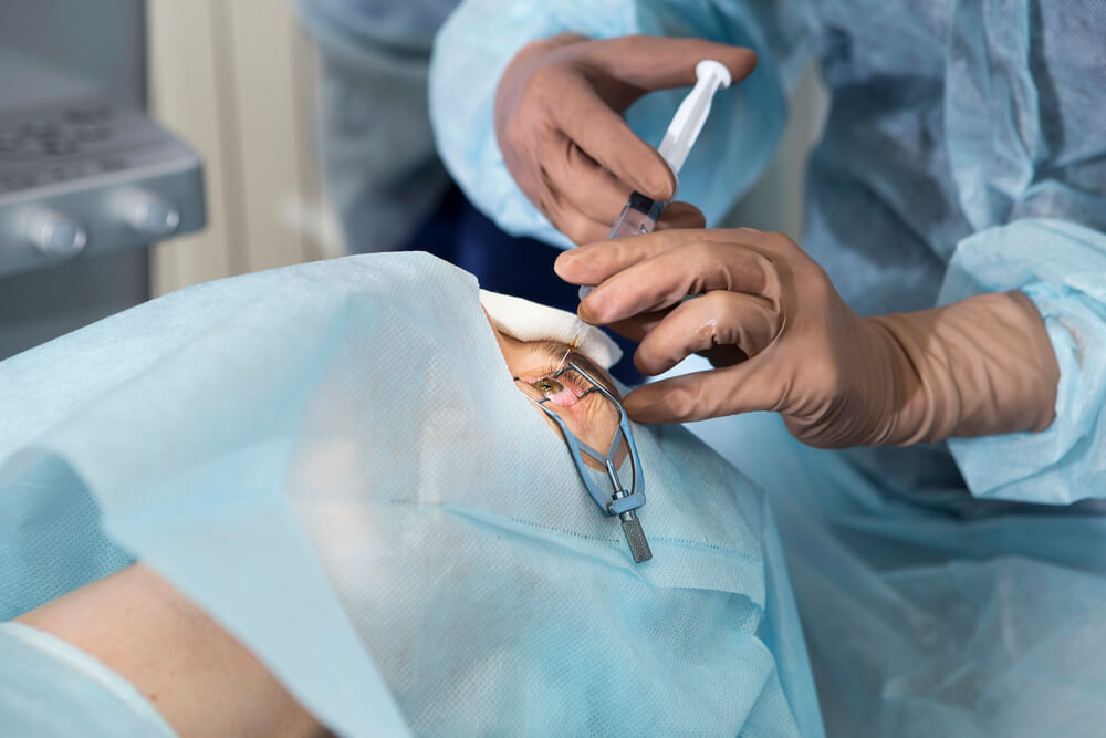 Can LASIK Patients Have Cataract Surgery