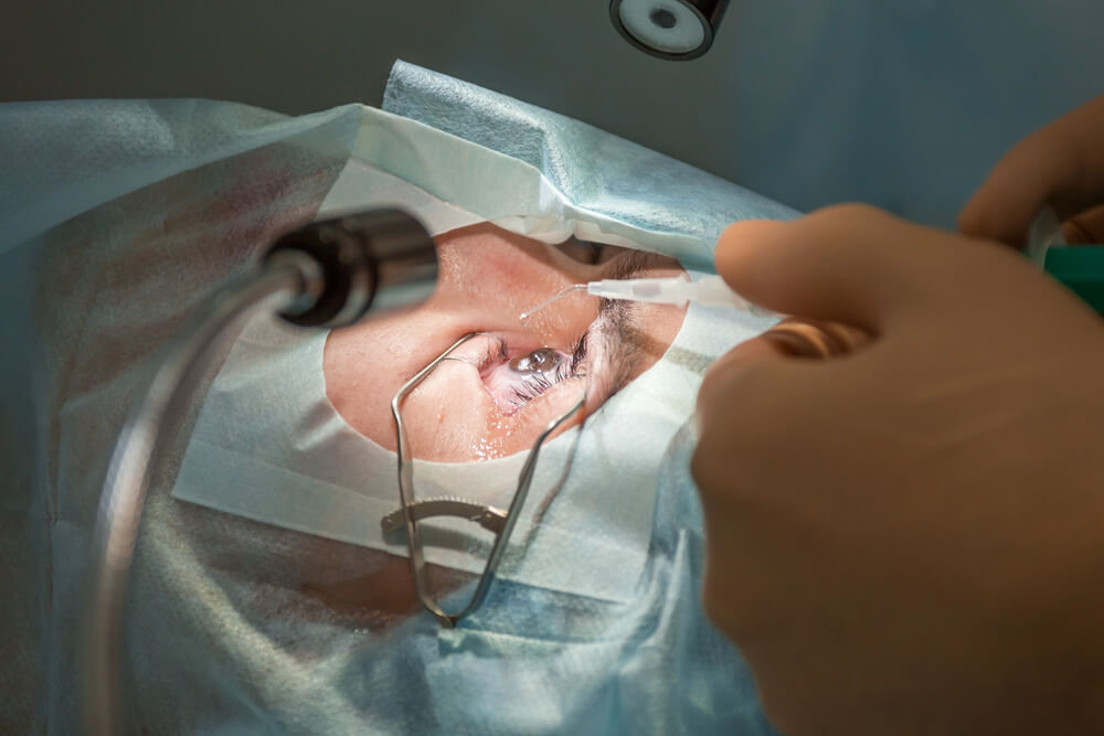 Keep Your Eyes Still During LASIK