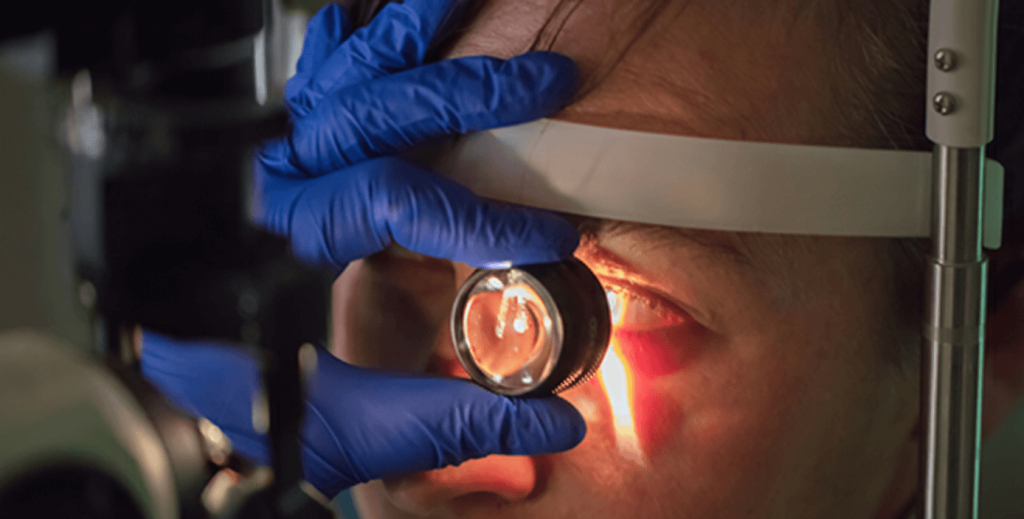 Autoimmune Conditions Linked to the Development of Cataracts